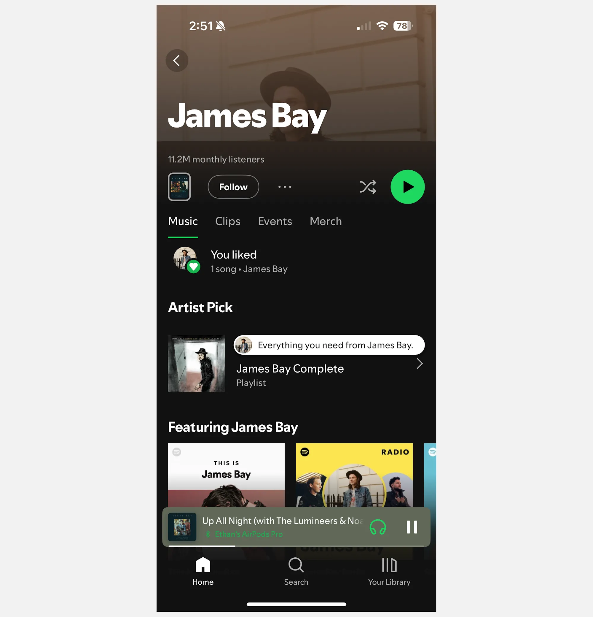 Giao diện Spotify với lỗi không hiển thị danh sách album của nghệ sĩ